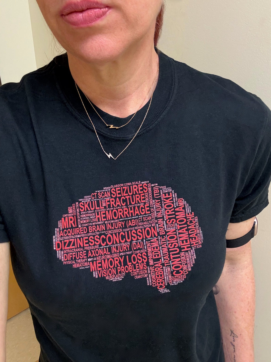 Why Brain Injury Awareness Matters: The Silent Epidemic